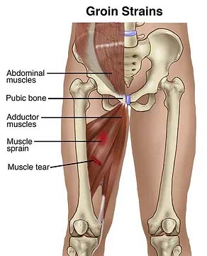 Groin Strains Diagram